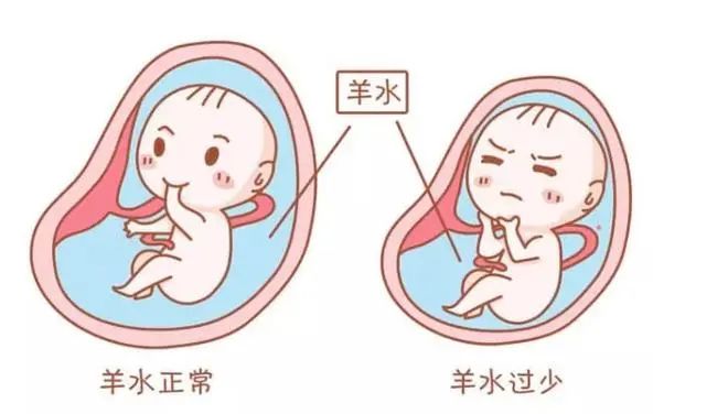 【科普】怀孕突然“见红”是要流产了吗?出血、腹痛、并发症，孕期异常问题怎么处理?(图7)