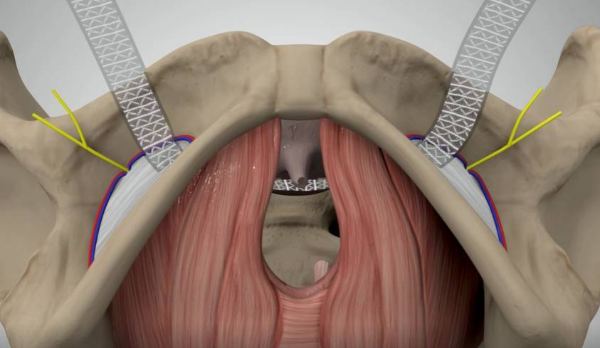 科普世界尿失禁周将至丨90产后妈妈都会中招的难言之隐